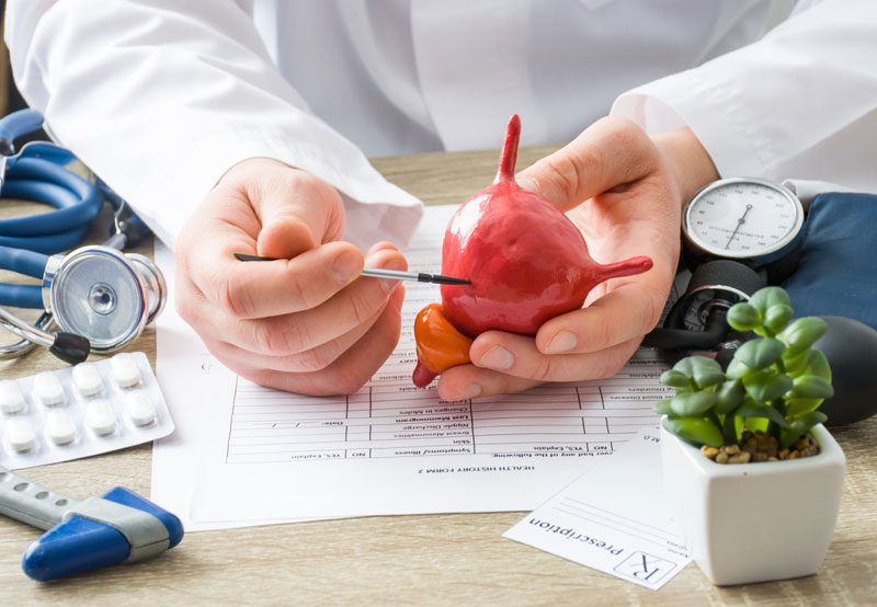 Doctor-holding-anatomical-bladder-model Doctor-holding-anatomical-bladder-model