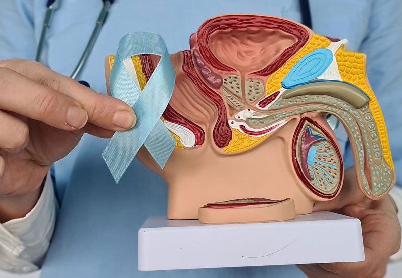 Doctor-holding-prostate-model-and-awareness-ribbon Doctor-holding-prostate-model-and-awareness-ribbon