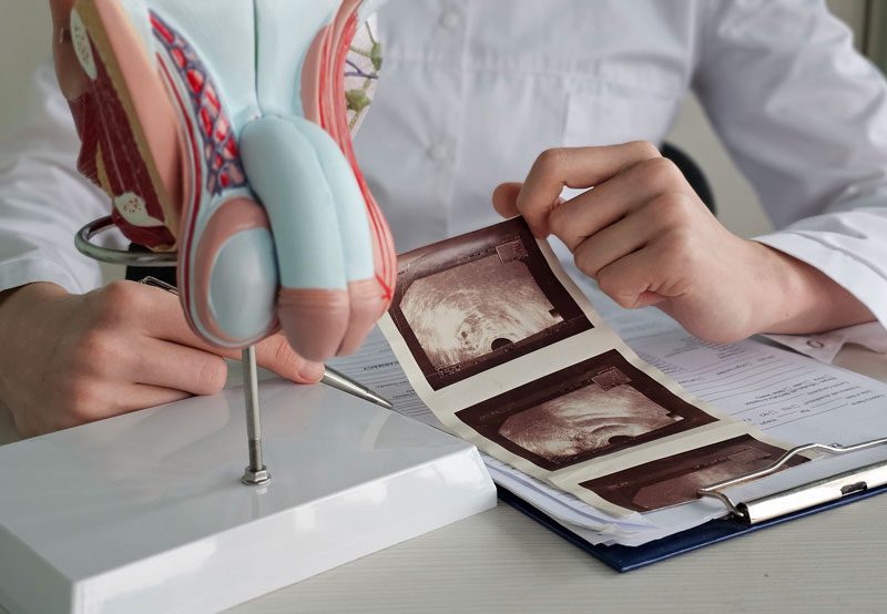 Doctor-reviewing-ultrasound-images-beside-male-anatomy-model Doctor-reviewing-ultrasound-images-beside-male-anatomy-model